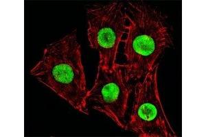 Fluorescent image of C2C12cells stained with Hmga2 antibody at 1:25 dilution. (HMGA2 antibody  (C-Term))