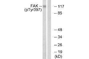Immunohistochemistry analysis of paraffin-embedded human brain tissue using FAK (Phospho-Tyr397) antibody.
