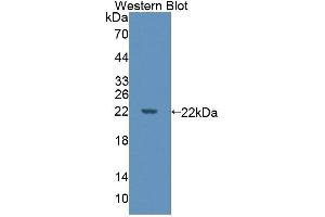 Detection of Recombinant DPPA3, Human using Polyclonal Antibody to Developmental Pluripotency Associated Protein 3 (DPPA3)