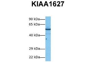 Host:  Rabbit  Target Name:  KIAA1627  Sample Tissue:  Human PANC1  Antibody Dilution:  1. (KIAA1627 antibody  (N-Term))