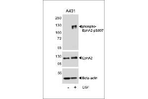 Western blot analysis of lysates from A431 cell line, untreated or treated with EGF, 100 ng/mL, using phospho-EphA2-p A (upper), EphA2 (middle) or Beta-actin (lower).
