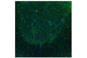 Sample Type :  Spinal Cord, ventral horns (Serotonin Receptor 3B antibody  (N-Term))