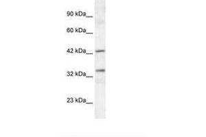 Image no. 2 for anti-TATA Box Binding Protein (TBP)-Associated Factor, RNA Polymerase I, A, 48kDa (TAF1A) (C-Term) antibody (ABIN6735836) (TAF1A antibody  (C-Term))