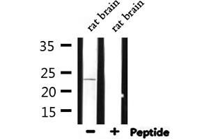Western blot analysis of extracts from rat brain, using ARF4 Antibody. (ARF4 antibody  (Internal Region))
