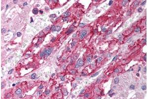 anti-Solute Carrier Family 18 (Vesicular Monoamine Transporter), Member 1 (SLC18A1) (AA 103-152) antibody