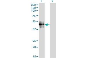 Western Blot analysis of CD177 expression in transfected 293T cell line by CD177 monoclonal antibody (M01), clone 4C4.