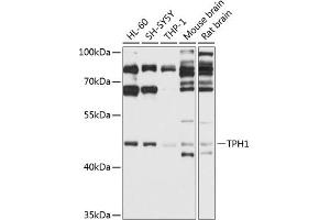 Western blot analysis of extracts of various cell lines, using TPH1 antibody (ABIN3022154, ABIN3022155, ABIN3022156 and ABIN6218634) at 1:1000 dilution.