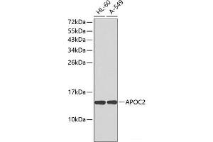 Western blot analysis of extracts of various cell lines using APOC2 Polyclonal Antibody. (Apolipoprotein C-II antibody)