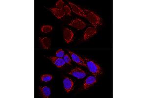 Confocal immunofluorescence analysis of U2OS cells using MTX2 Polyclonal Antibody (ABIN6129694, ABIN6144192, ABIN6144193 and ABIN6223964) at dilution of 1:100. (MTX2 antibody  (AA 1-263))