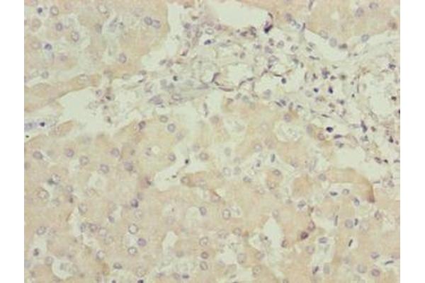 ANKRA2 antibody  (AA 1-313)