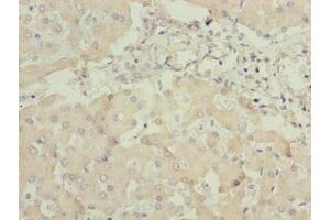 Immunohistochemistry of paraffin-embedded human liver tissue using ABIN7144243 at dilution of 1:100 (ANKRA2 antibody  (AA 1-313))