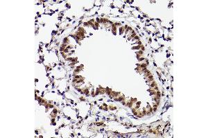 Immunohistochemistry (IHC) image for anti-Activating Transcription Factor 5 (ATF5) antibody (ABIN7265407)