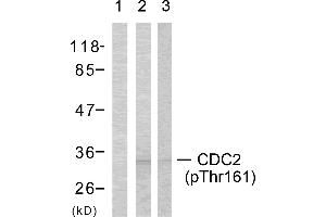 Western blot analysis using CDC2 (Phospho-Thr161) Antibody: Lin: The extracts from COLO cells using preincubated with synthesized phosphopeptide; Lin: The extracts from COLO cells. (CDK1 antibody  (pThr161))