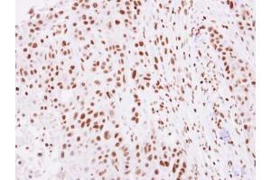 IHC-P Image Immunohistochemical analysis of paraffin-embedded SCC4 xenograft, using Histone H2A. (H2AFZ antibody  (N-Term))