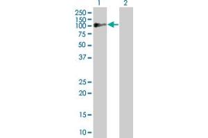 Lane 1: PDCD6IP transfected lysate ( 95.