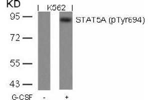 Image no. 1 for anti-Signal Transducer and Activator of Transcription 5A (STAT5A) (pTyr694) antibody (ABIN196697) (STAT5A antibody  (pTyr694))
