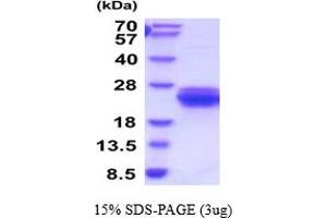 SDS-PAGE (SDS) image for C-Type Lectin Domain Family 7, Member A (CLEC7A) (AA 71-244) protein (His tag) (ABIN5854489) (CLEC7A Protein (AA 71-244) (His tag))