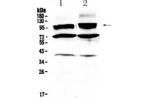 Western blot analysis of HCN2 using anti- HCN2 antibody .