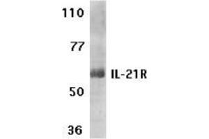 Western blot analysis of IL-21 receptor expression in human Raji cell lysate with AP30415PU-N IL-21 receptor antibody at 1 μg /ml. (IL21 Receptor antibody  (N-Term))