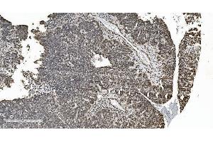 IHC analysis of HNRNPH3 using anti-HNRNPH3 antibody (ABIN7601121). (HNRNPH3 antibody  (AA 29-268))