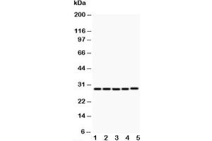 Western blot testing of CD40L antibody and Lane 1:  MCF-7 (CD40 Ligand antibody  (N-Term))