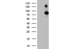 HEK293T cells were transfected with the pCMV6-ENTRY control (Left lane) or pCMV6-ENTRY DGKA (Right lane) cDNA for 48 hrs and lysed. (DGKA antibody)