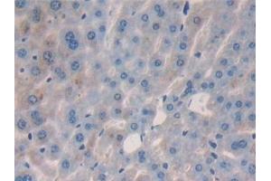Detection of IL2 in Mouse Liver Tissue using Polyclonal Antibody to Interleukin 2 (IL2) (IL-2 antibody  (AA 10-169))