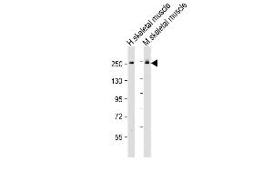 All lanes : Anti-MYH6 Antibody (Center) at 1:2000 dilution Lane 1: human skeletal muscle lysate Lane 2: mouse skeletal muscle lysate Lysates/proteins at 20 μg per lane. (MYH6 antibody  (AA 833-867))