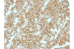 Immunohistochemical staining (Formalin-fixed paraffin-embedded sections) of human parathyroid with PTH recombinant monoclonal antibody, clone PTH/1717R . (Recombinant PTH antibody  (N-Term))