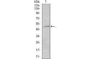 Western blot analysis using KRT13 mouse mAb against T47D (1) cell lysate. (Cytokeratin 13 antibody  (AA 143-295))