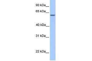 WB Suggested Anti-MTL5 Antibody Titration: 0. (MTL5 antibody  (N-Term))