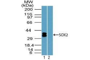 Image no. 1 for anti-SRY (Sex Determining Region Y)-Box 2 (SOX2) (AA 100-150) antibody (ABIN1490795) (SOX2 antibody  (AA 100-150))