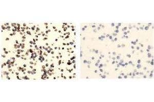 Immunohistochemistry (IHC) image for anti-Tumor Necrosis Factor Receptor Superfamily, Member 13C (TNFRSF13C) antibody (ABIN1449226) (TNFRSF13C antibody)
