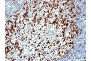 Formalin-fixed, paraffin-embedded human Tonsil stained with PD1 (CD279) Monoclonal Antibody (NAT105). (PD-1 antibody)