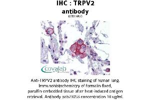 Image no. 2 for anti-Transient Receptor Potential Cation Channel, Subfamily V, Member 2 (TRPV2) (AA 595-764) antibody (ABIN1740401) (TRPV2 antibody  (AA 595-764))
