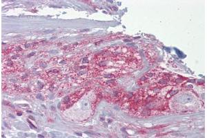 Anti-NCS-1 antibody IHC staining of human small intestine, myenteric plexus. (NCS1 antibody  (C-Term))