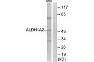 Western blot analysis of extracts from K562 cells, using ALDH1A2 Antibody. (ALDH1A2 antibody  (AA 412-461))