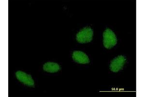 Immunofluorescence of purified MaxPab antibody to ZNF549 on HeLa cell. (ZNF549 antibody  (AA 1-640))