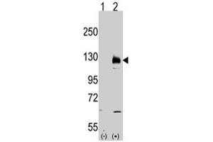 Western blot analysis of TRPM8 (arrow) using rabbit TRPM8 polyclonal antibody . (TRPM8 antibody  (AA 933-963))