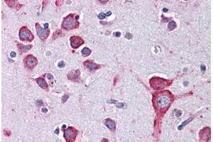 Human Brain, Cortex: Formalin-Fixed, Paraffin-Embedded (FFPE) (Serotonin Receptor 1A antibody)