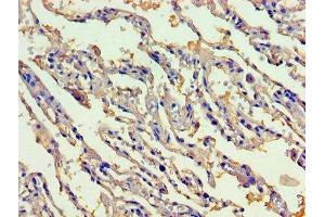 Immunohistochemistry of paraffin-embedded human lung tissue using ABIN7148026 at dilution of 1:100 (CBLIF (AA 19-417) antibody)