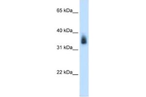 Western Blotting (WB) image for anti-Melanoma Antigen Family A, 8 (MAGEA8) antibody (ABIN2462552)