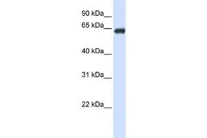 Western Blotting (WB) image for anti-Solute Carrier Family 39 (Zinc Transporter), Member 4 (SLC39A4) antibody (ABIN2458809)