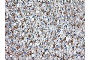 Immunohistochemical staining of paraffin-embedded Human prostate tissue using anti-C17orf28 mouse monoclonal antibody. (HID1/DMC1 antibody)