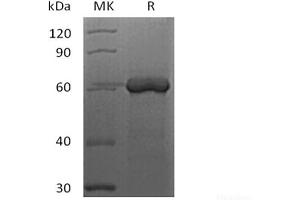 Western Blotting (WB) image for Fibrinogen-Like 1 (FGL1) (Active) protein (Biotin) (ABIN7319770) (FGL1 Protein (Biotin))