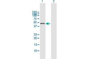 Western Blot analysis of CTBS expression in transfected 293T cell line by CTBS MaxPab polyclonal antibody. (CTBS antibody  (AA 1-385))