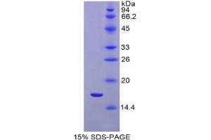 SDS-PAGE analysis of Rat IL1R1 Protein.