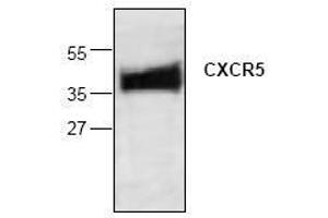 Image no. 1 for anti-Chemokine (C-X-C Motif) Receptor 5 (CXCR5) antibody (ABIN127100) (CXCR5 antibody)