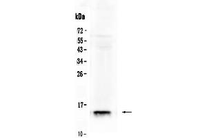 Western blot analysis of FABP2/I-FABP using anti- FABP2/I-FABP antibody . (FABP2 antibody  (AA 2-132))