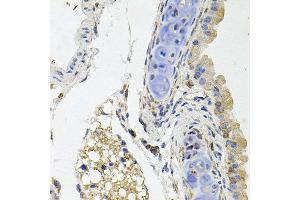Immunohistochemistry of paraffin-embedded mouse lung using SDC2 antibody at dilution of 1:100 (x40 lens). (Syndecan 2 antibody)
